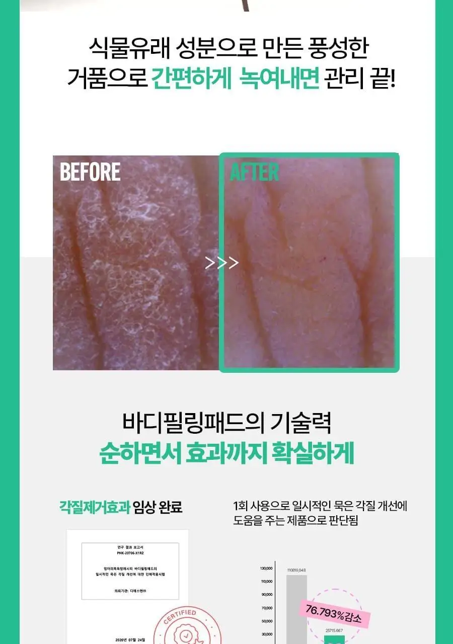 [520만장판매] 엄마의목욕탕레시피 바디필링패드 8매입 (오리지널/스트롱/트러블케어) 상세페이지 11